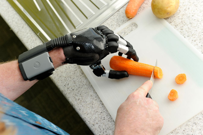 Sanitätskaufhaus Kellner - Relaunch 2025 - elektrische Handprothese hält Gemüse während Nutzer das Gemüse klein schneidet